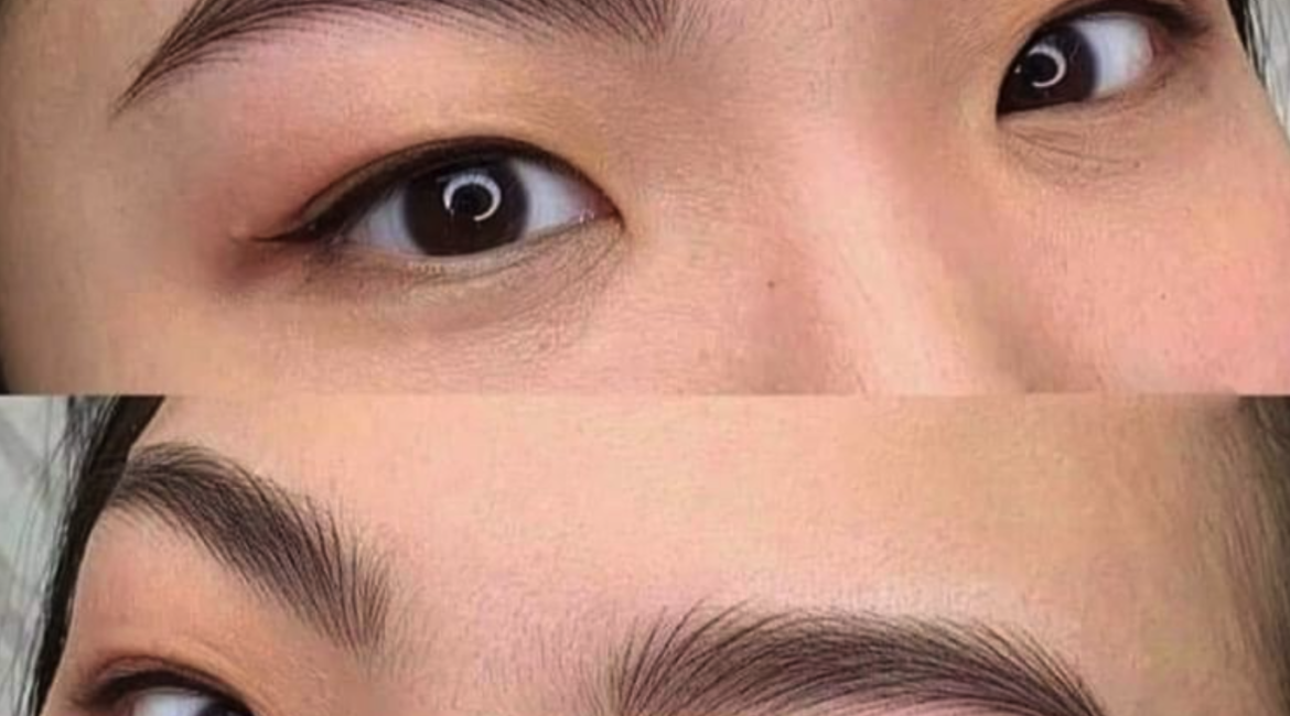 post_thumbnail